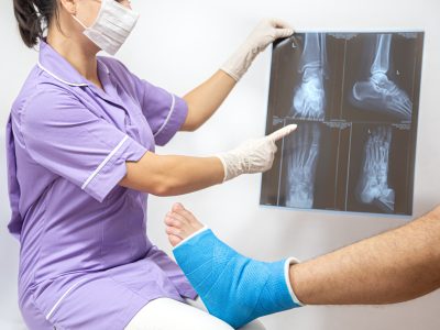 Bone fracture foot and leg on male patient being examined by a woman doctor in a hospital. Female doctor in a blue medical gown checking broken leg and shows the male patient lateral projection x-ray of foot and ankle.